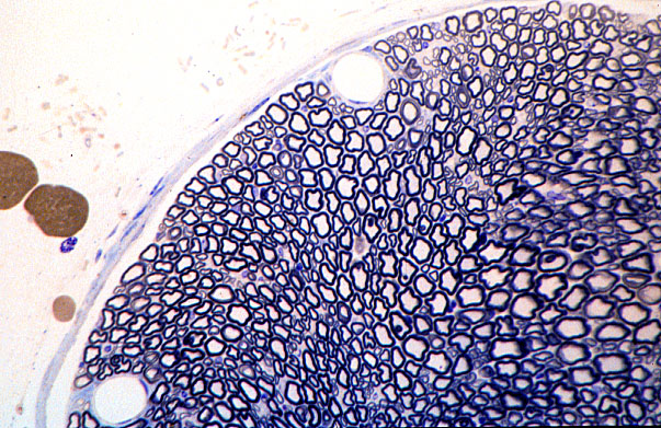  peripheral nerve, osmium fixed 