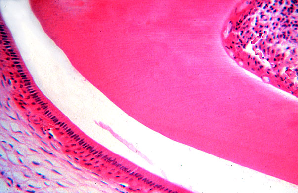  fetal rat, developing tooth 