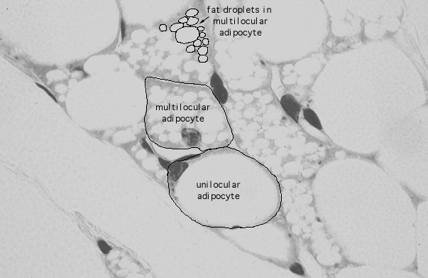  multilocular (brown) adipocytes 