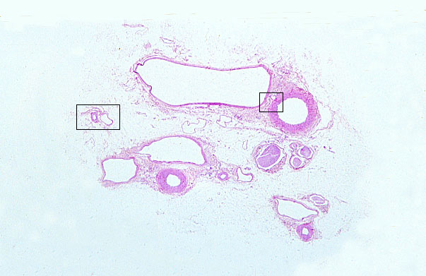  muscular arteries and medium veins, femoral 