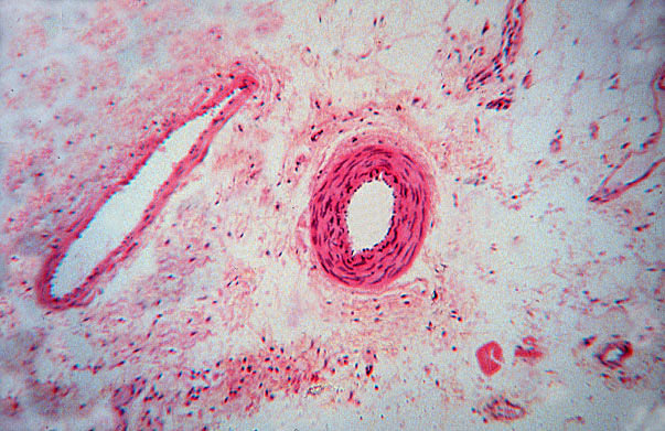  medium muscular artery 