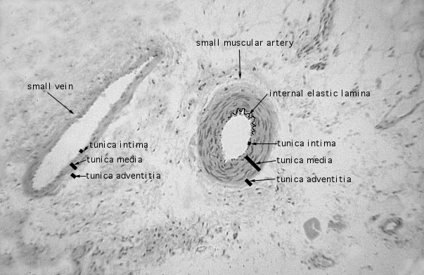  medium muscular artery 