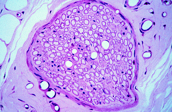  muscular arteries and medium veins, radial 
