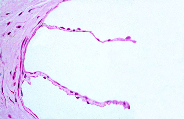  vein valve 