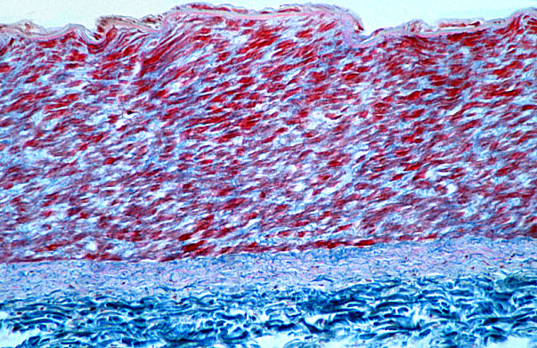  large muscular artery 