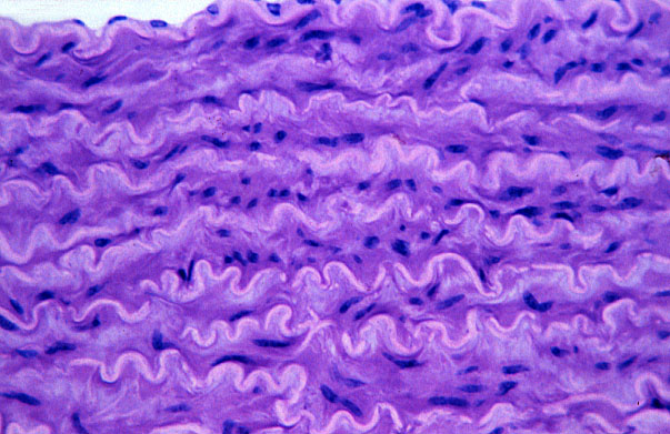  elastic artery, Lee's 
