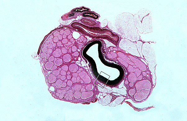  arteries, Verhoeff's 