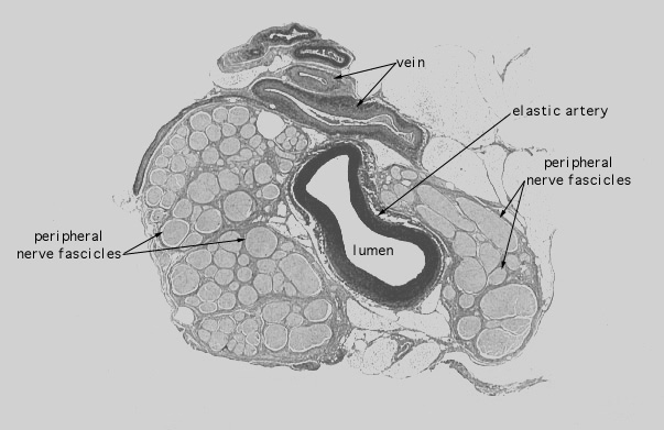  arteries, Verhoeff's 