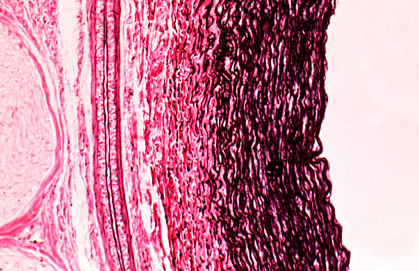  arteries, Verhoeff's 