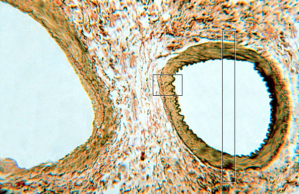  arteries, Verhoeff's 