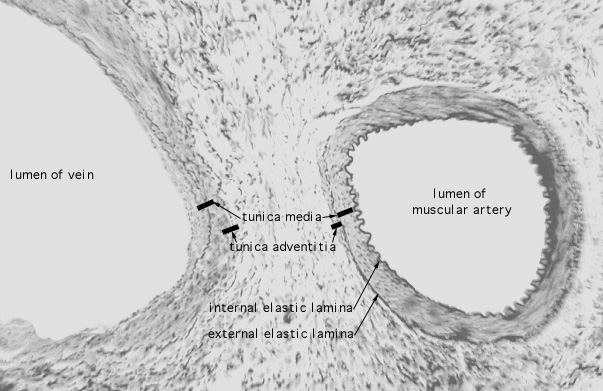  arteries, Verhoeff's 