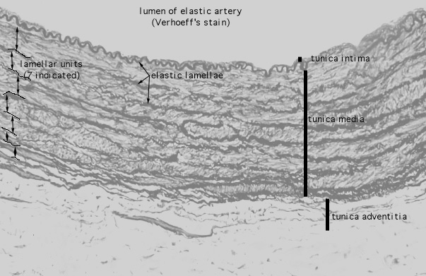  arteries, Verhoeff's 