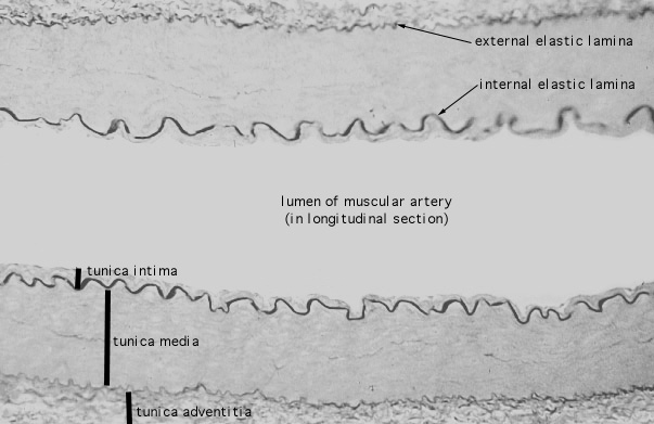  arteries, Verhoeff's 