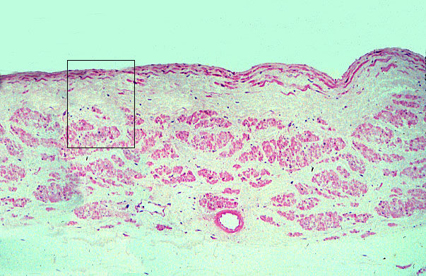  large vein 