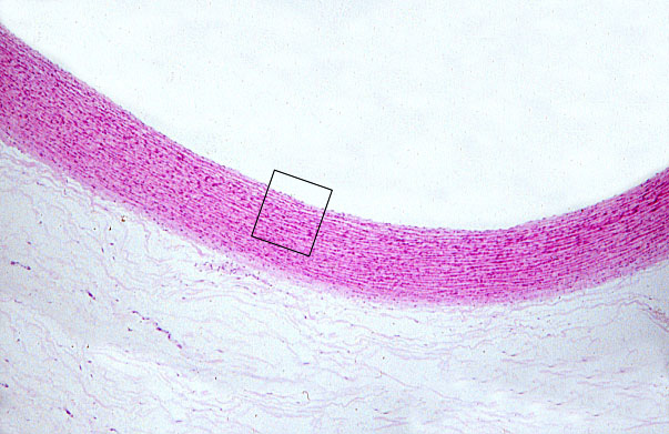  aorta, H&E 