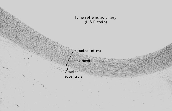  aorta, H&E 