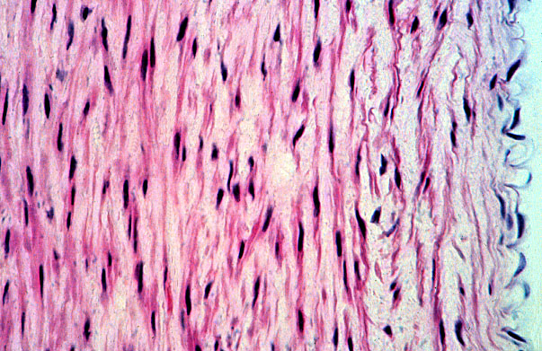  aorta, H&E 