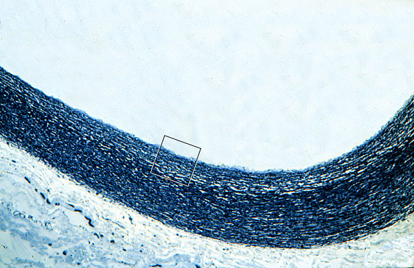  aorta, Verhoeff's 