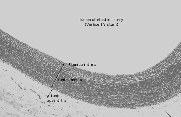  aorta, Verhoeff's 