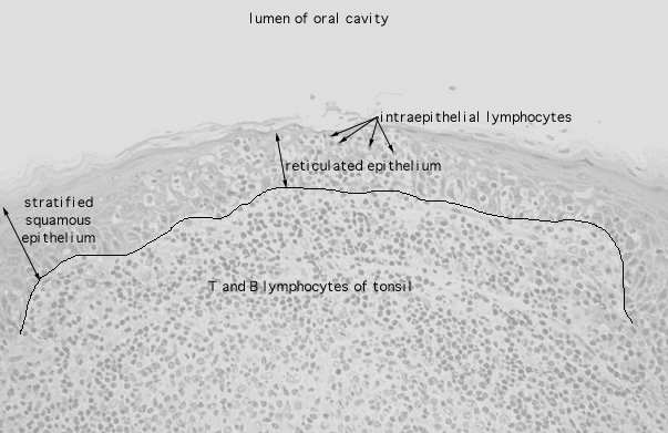  tonsil, reticulated epithelium 
