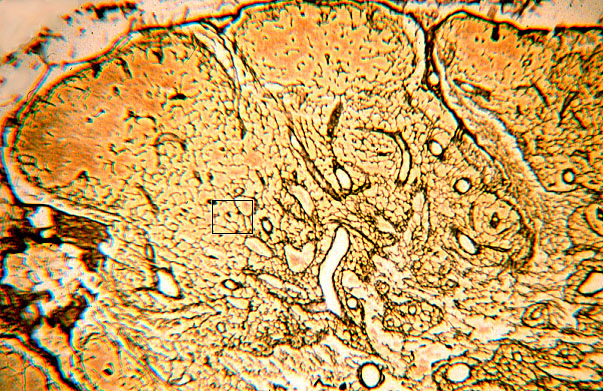  reticular fibers 