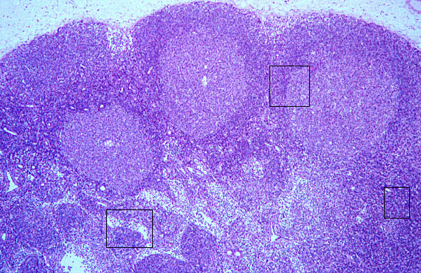 lymph node, cortex and medulla 