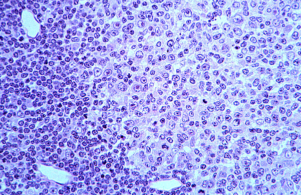  lymph node, germinal center 