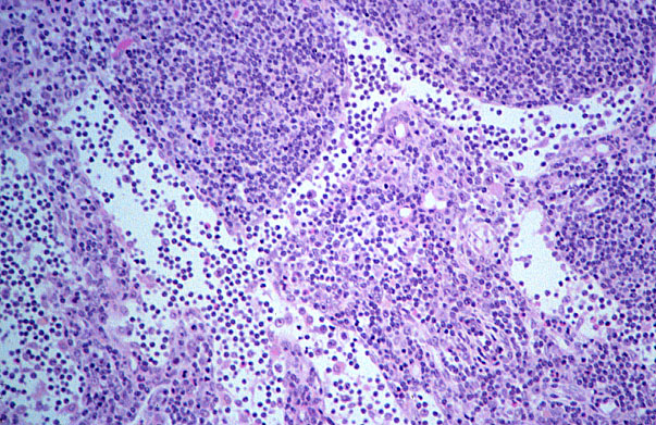  lymph node, medullary sinus 