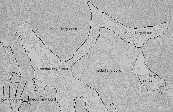  lymph node, medullary sinus 