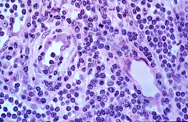  lymph node, HEV 