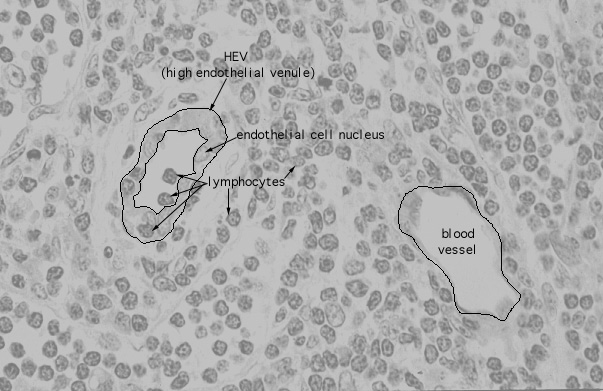  lymph node, HEV 
