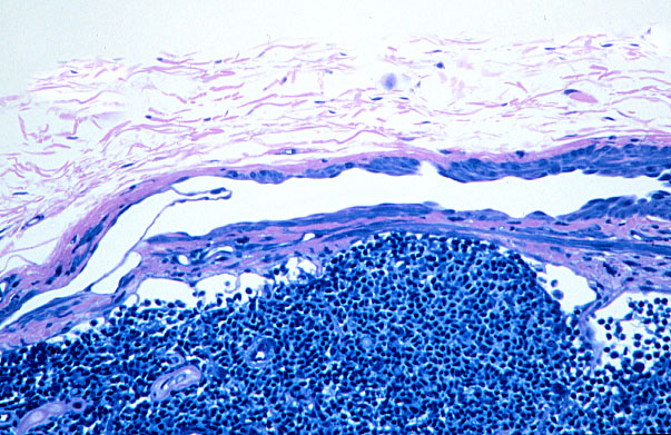  lymph node, afferent arterioles 