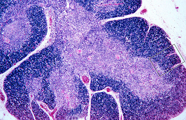  thymus 