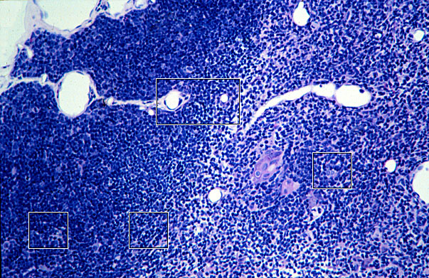  thymus 