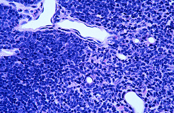  thymus, cortical vessels 