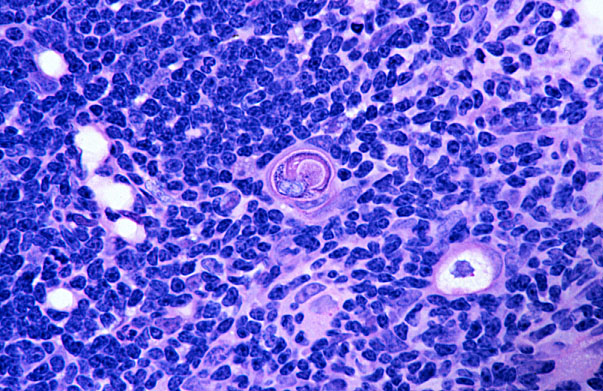  thymus, Hassall's corpuscles 
