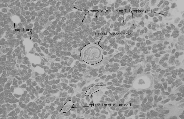  thymus, Hassall's corpuscles 