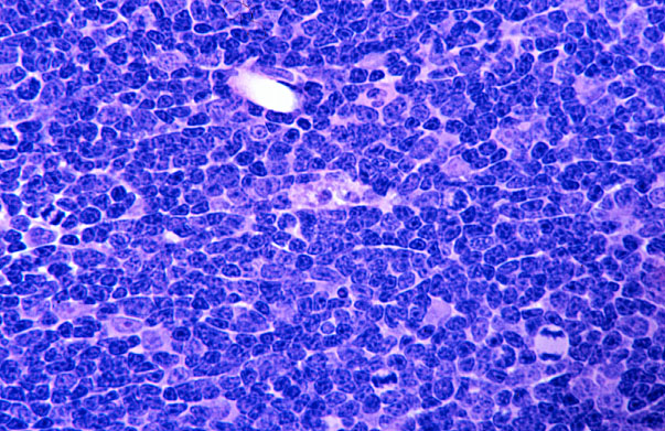  thymus, macrophages 