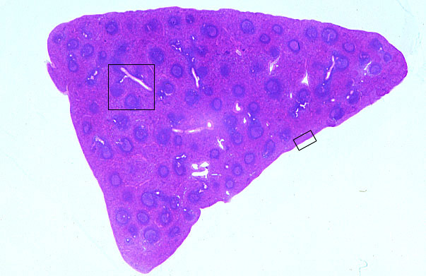  spleen 