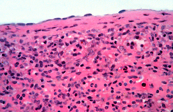  spleen, capsule 