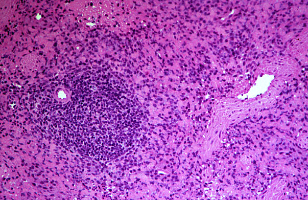  spleen, central artery and trabecular vein 