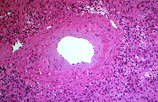  spleen, trabecular artery 