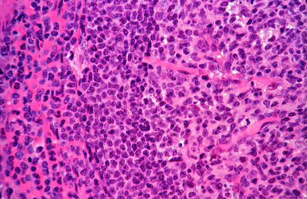  spleen, radial arterioles 