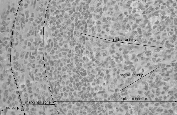  spleen, radial arterioles 