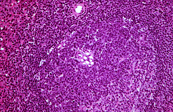  spleen, penicillar arterioles 
