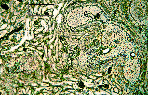  splenic reticulum 