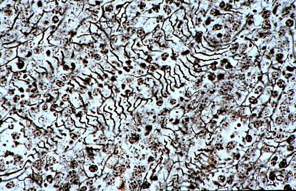  splenic reticulum 