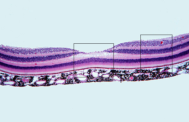  fovea 