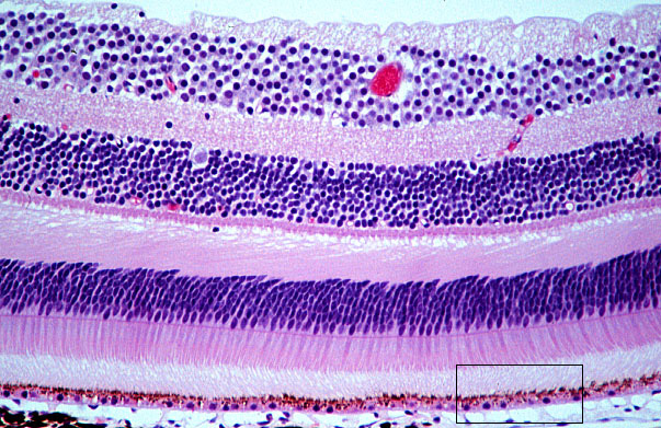 fovea, retina 