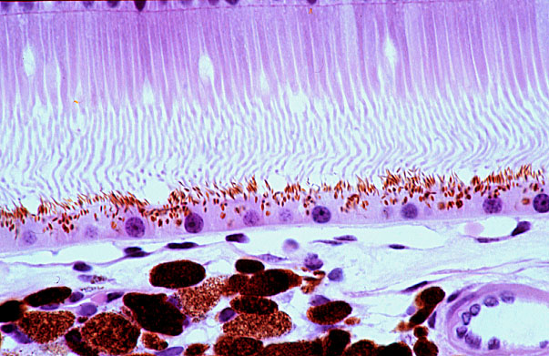  fovea, RPE 